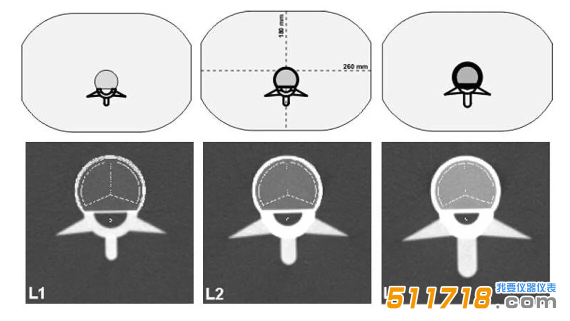 QRM-ESP 的 CT 图像。椎体中段扫描图像，并叠加了自动确定的松质骨和皮质骨 ROI。.png